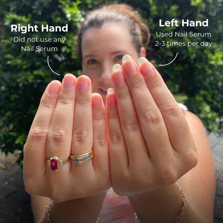 Zalia Nail Rescue Pen - Natural Nail Growth & Cuticle Oil