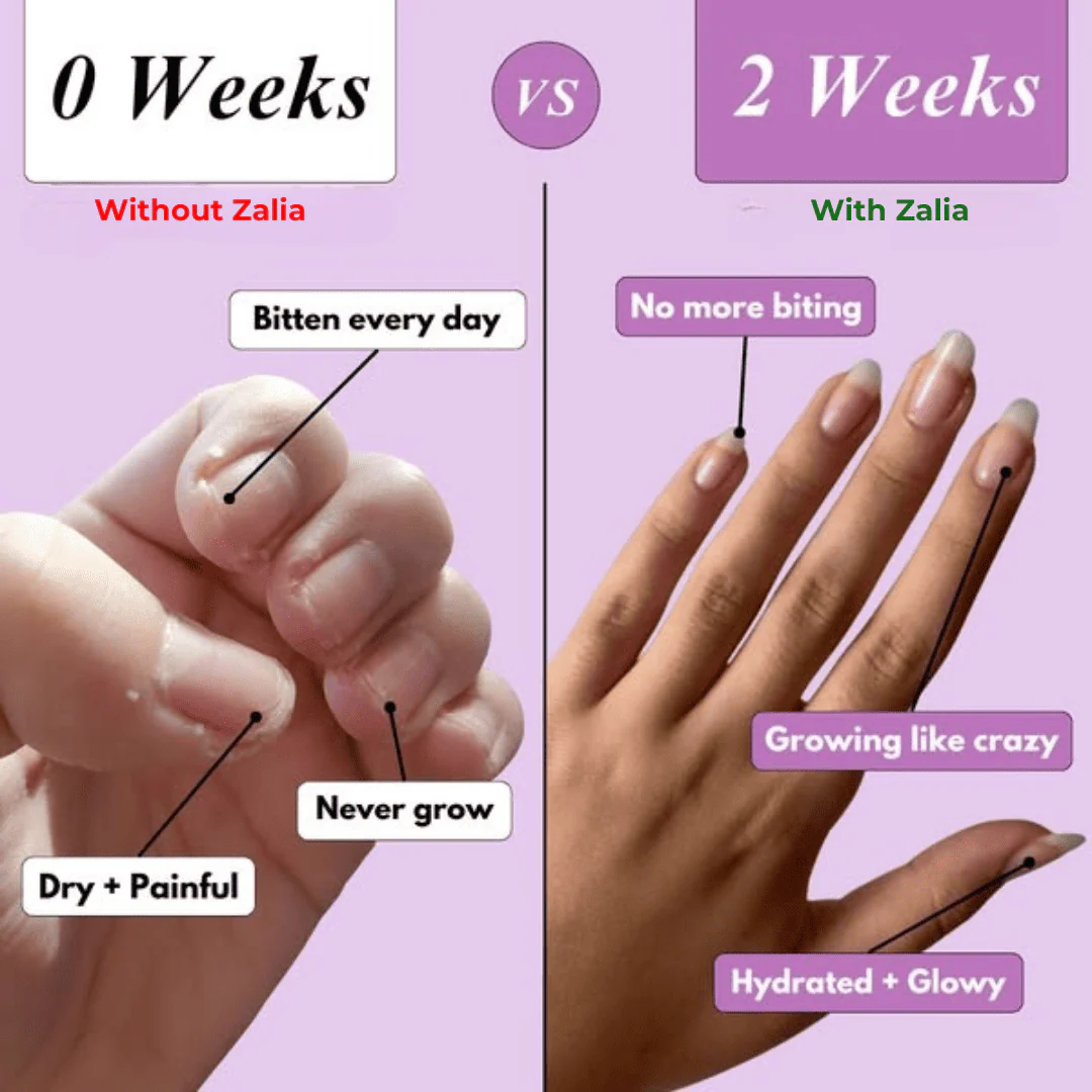 Zalia Nail Rescue Pen - Natural Nail Growth & Cuticle Oil