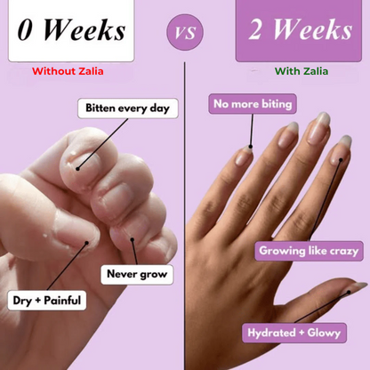 Zalia Nail Rescue Pen - Natural Nail Growth & Cuticle Oil